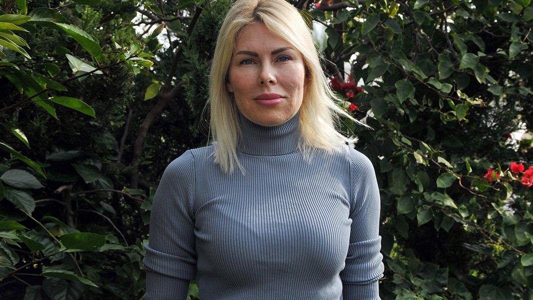 Prof. Dr. Özkan: Ya aşı olacağız ya corona