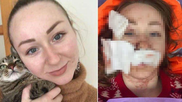 Ukraynalı kadına falçatalı saldırı yapan kocası tutuklandı