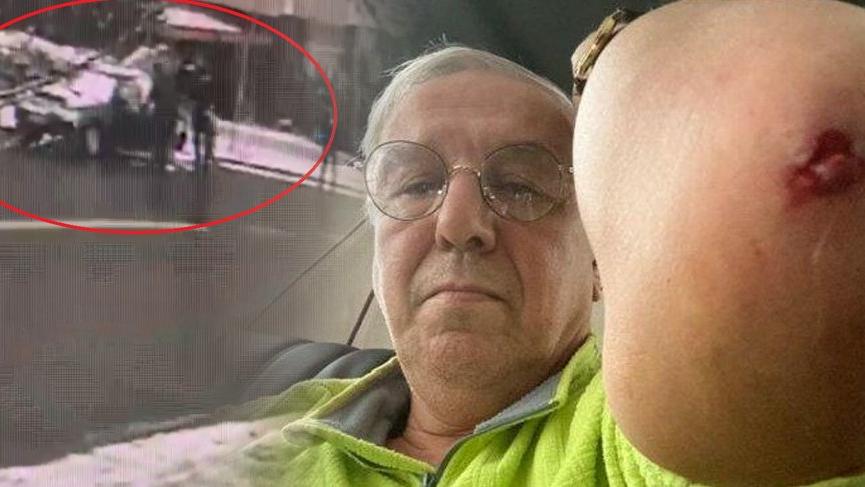 Ankara'da bir saldırı daha! Önce siyasetçi sonra da gazeteci dövüldü