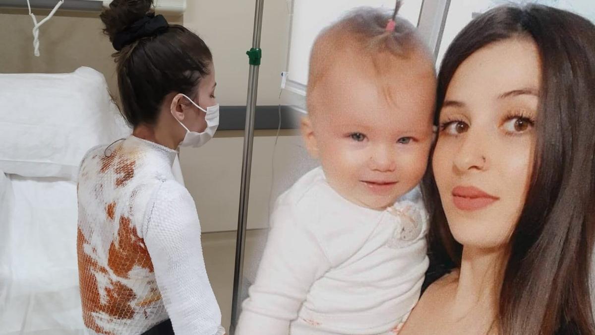 Eşini ve 1,5 yaşındaki kızını sıcak suyla yaktı