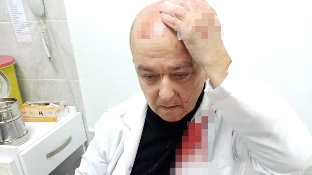 Maske uyarısı yapan doktorun kafasını yardı