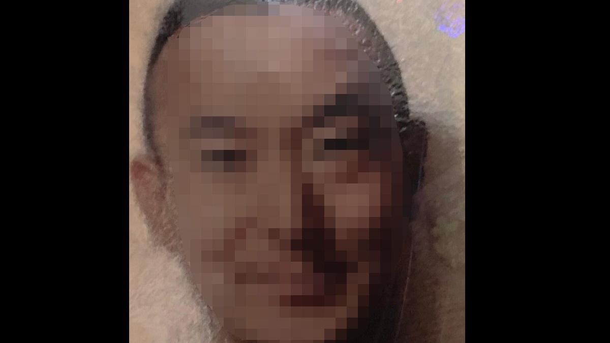 Japonya'dan saç ekimi için geldi, hayatından oldu