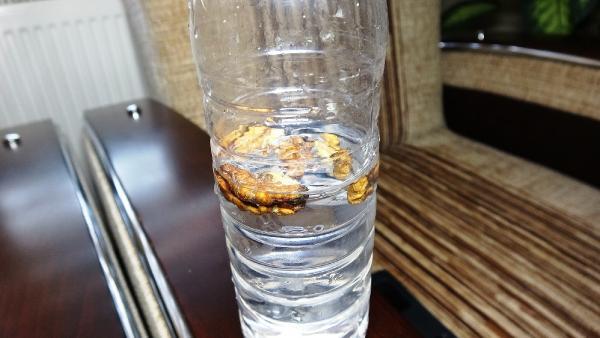 Nefes darlığı çektiği için korona olduğunu düşünen adamın akciğerinden ceviz çıktı