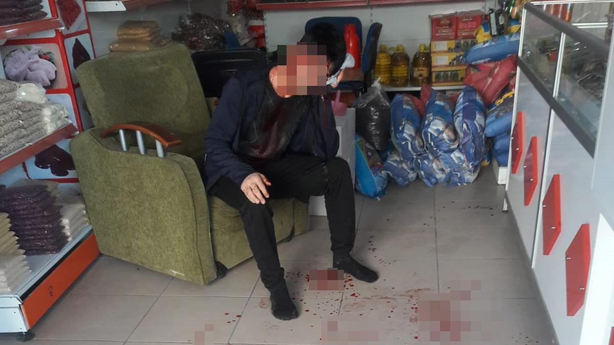 Gasp için geldiler, başaramayınca 5 yerinden bıçaklayıp kaçtılar