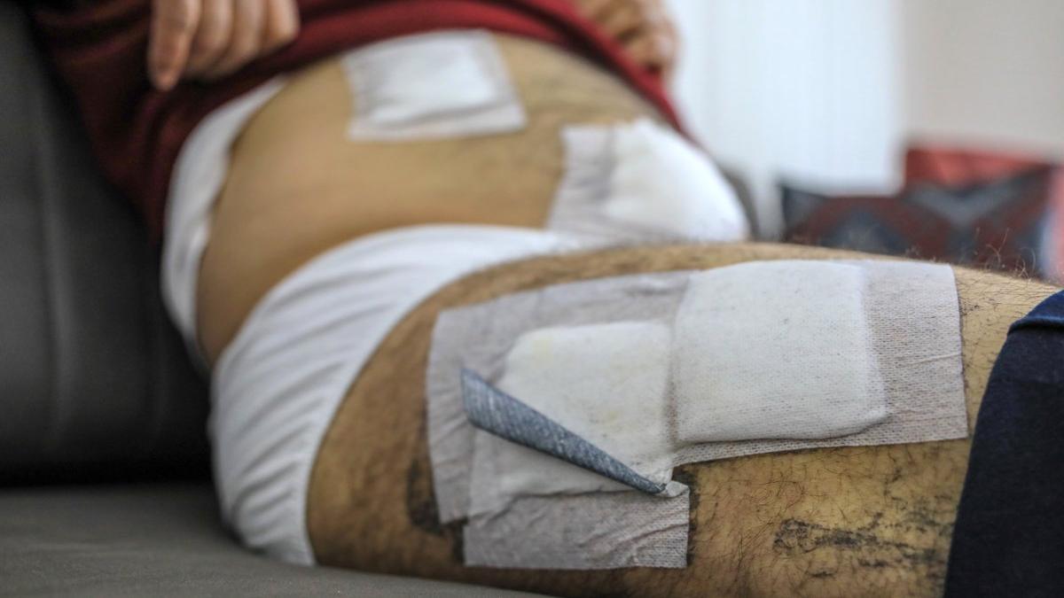 Uyuşturucuya engel olmak istedi, 5 yerinden bıçaklandı