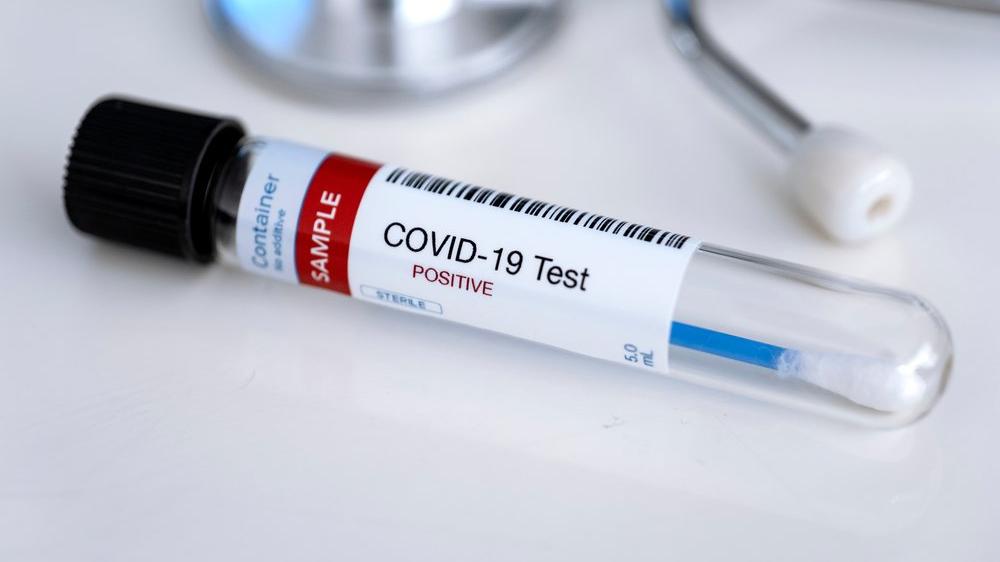 Covid-19'a ikinci kez yakalanmak mümkün mü? Antikorlar ve semptomlar...