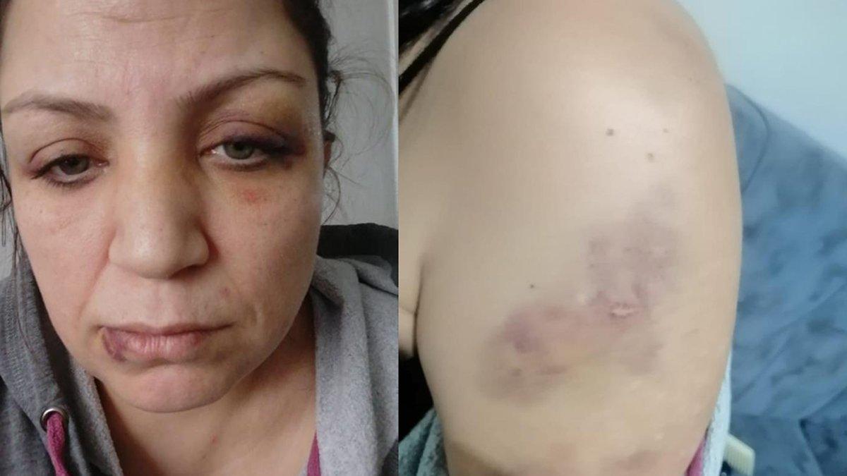 Vahim iddia! Pandemi nedeniyle kirasını ödeyemedi, bayılana kadar dövüldü