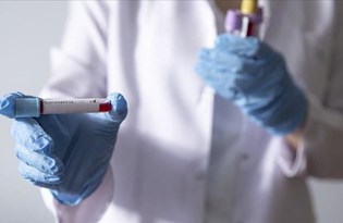 Fransa’da cep telefonuyla yapılan corona virüs testi geliştirildi