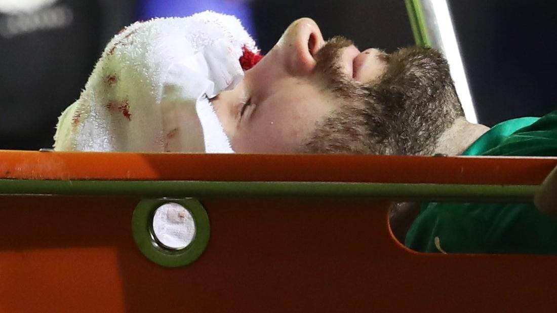 Glasgow Rangers-Slavia Prag maçında rakibinin uçan tekmesi hastanelik etti