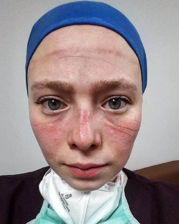 Yüzünün fotoğrafı sosyal medyada elden ele dolanan Seher hemşire konuştu: Evde bile hissediyorum