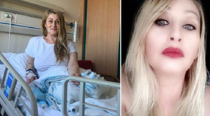 Estetik ameliyat sonrası dudağı çürümüştü… Songül için güzel haber