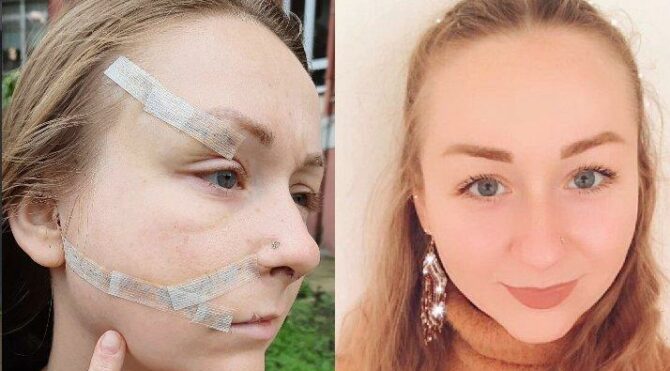 Falçata vahşetini anlattı… Hanna, korku içerisinde yaşıyor