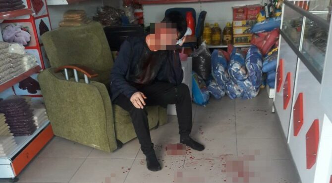 Gasp için geldiler, başaramayınca 5 yerinden bıçaklayıp kaçtılar