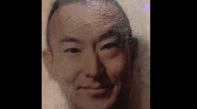 Japonya’dan saç ekimi için geldi, hayatından oldu