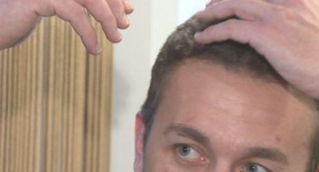 Kelliğe çare mi bulundu?