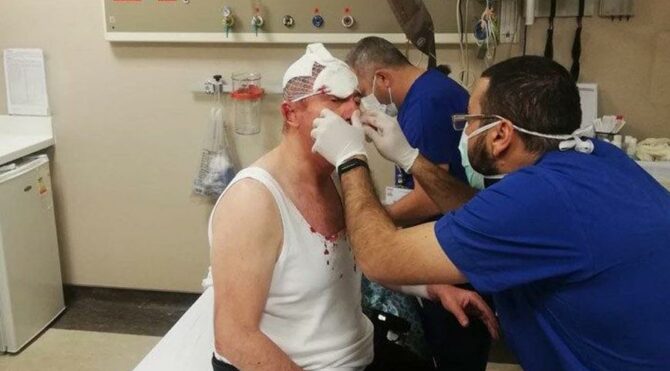 Özdağ’a saldıran kişi Erdoğan’ı tehdit etmiş