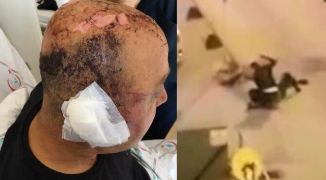 Polisin kafasını telsizle parçaladı, 1,5 yıldır yargılanamıyor