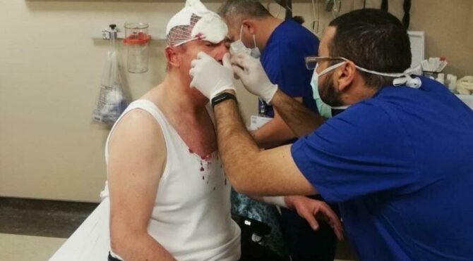 Selçuk Özdağ’a saldırı soruşturmasında firari 3 şüpheli için yakalama kararı