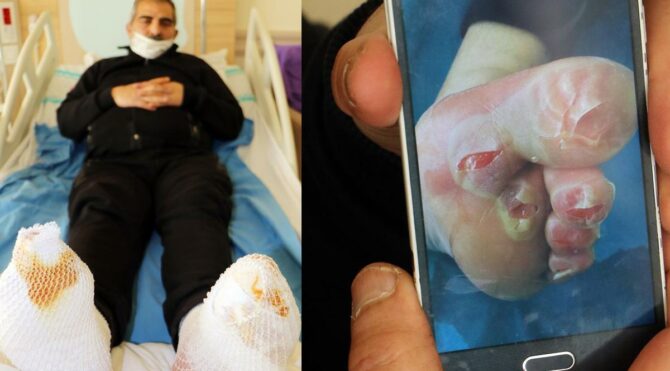 Seyir halindeki kamyonda ayakları dondu