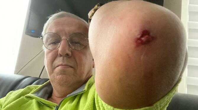 Son dakika… Ankara’da bir saldırı daha! Önce siyasetçi sonra da gazeteci dövüldü!