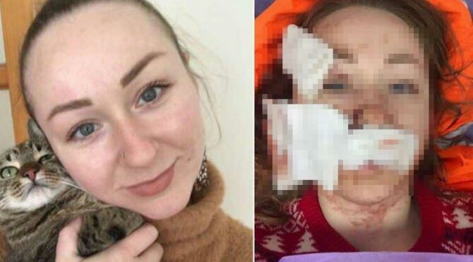 Ukraynalı kadına falçatalı saldırı yapan kocası tutuklandı