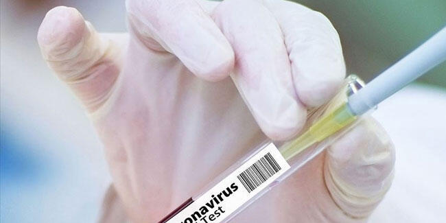 5 AB ülkesi, Kovid-19 aşı üretiminin hızlandırılması çağrısı yaptı