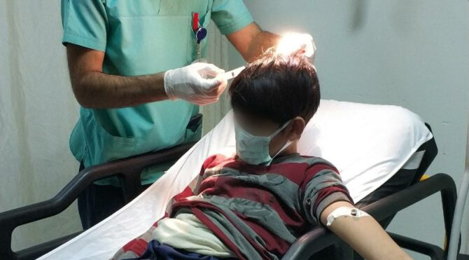 6 yaşındaki çocuk 13 yaşındaki ağabeyini odunla hastanelik etti