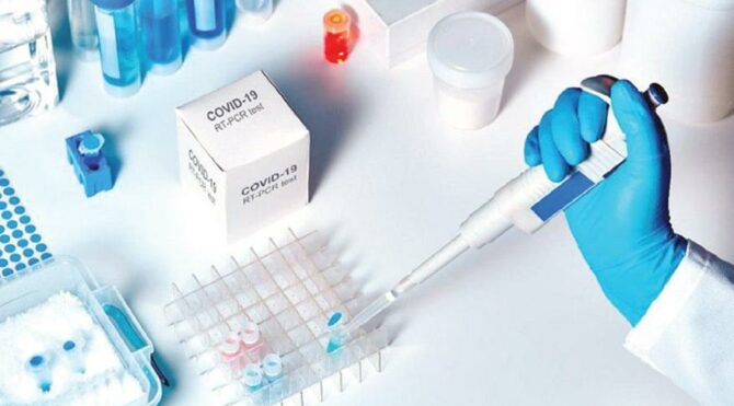 9.8 TL’LİK PCR testini 200 TL’ye almışlar