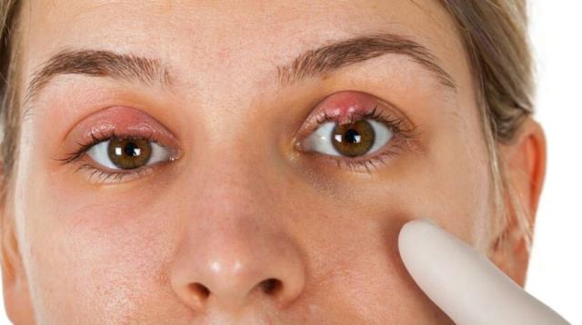 Dünya bu araştırmayı konuşuyor: Koronavirüsü yenen hastaların gözlerinde nodül oluşuyor