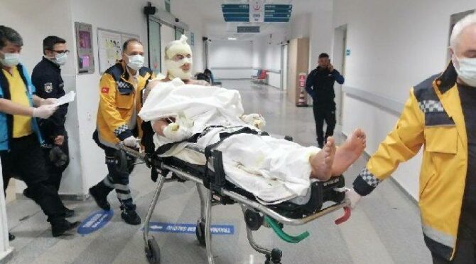 Hem kendini hem de oteli yaktı!