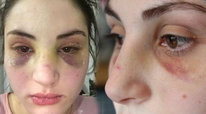 Kaçarak evlendiği eşi, genç kadına kâbusu yaşattı