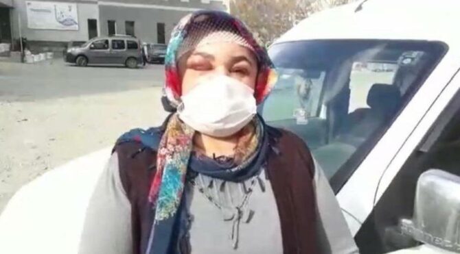 Miras yüzünden darp edilen kadın: Babam gibi öldürülmek istemiyorum