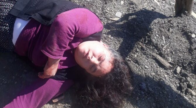 Miras yüzünden kız kardeşini öldüresiye dövdü