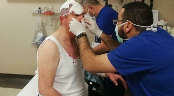 Selçuk Özdağ’a saldıranlar tahliye edildi