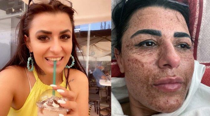 Takipçi sayısına kandı, yüzü yandı