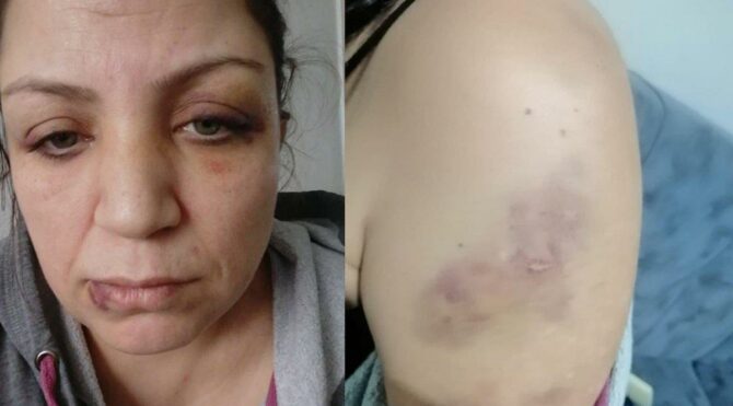 Vahim iddia! Pandemi nedeniyle kirasını ödeyemedi, bayılana kadar dövüldü