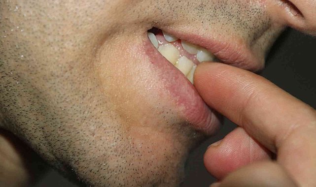 Evde kardeşler arası kıskançlık tırnak yeme alışkanlığına neden olabilir