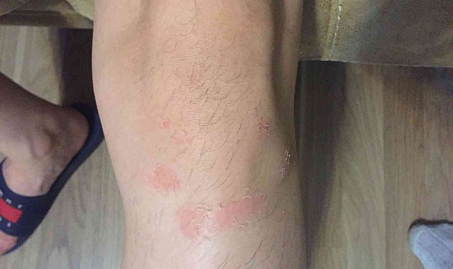 "Gazi polise yumruk attı, polis gaziye karakolda işkence yaptı" iddiası