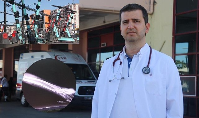 Uzmanlar uyardı: "Elektrikli scooter ölüm saçıyor"