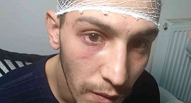 İş aramak için gittiği bölgede önce darp, ardından da gasp edildi
