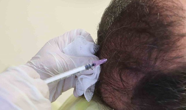 Cildiye profesöründen uyarı: "Saçkıran olan bölgeye sarımsak veya jilet sürmeyin"