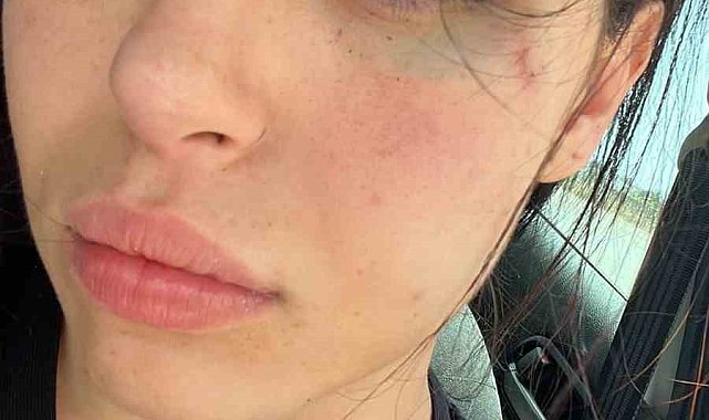 GKRY'da saldırıya uğrayan Karaali'nin duruşması 6 Temmuz'da yapılacak