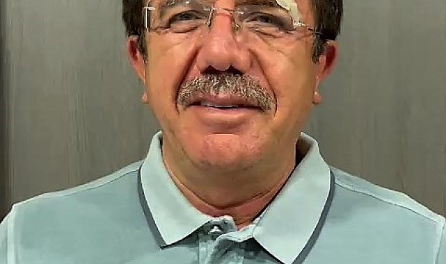 Kazada yaralanan eski bakan Zeybekci: "Şu anda gayet iyi durumdayız"